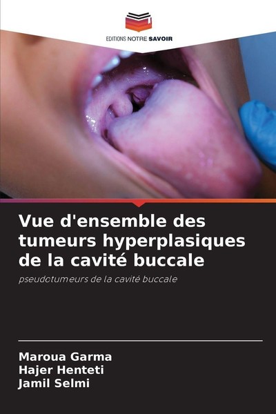 Vue D'ensemble Des Tumeurs Hyperplasiques De La Cavité Buccale Hajer Henteti-image
