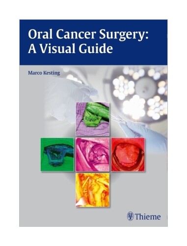 Thumbnail - Oral Cancer Surgery Von Marco Kesting