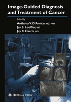 Jay R. Harris (U. A.) | Image-Guided Diagnosis And Treatment Of Cancer | Buch
