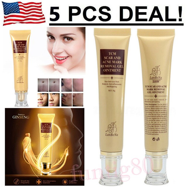 acne removal ointment