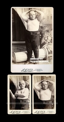 RARE SET of 3! Child Performer Willie Porter Circus Sideshow Fat Boy Freak CDV