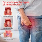 Hemorrhoids Ointment Internal External Anal Fissure Piles Hemorrhoids Cream — photo 5