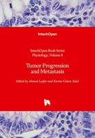 Tumor Progression And Metastasis Ahmed Lasfar