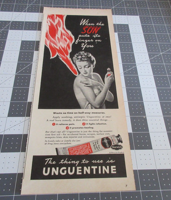 1946 Unguentine When the Sun puts its fingers on you Vintage Print Ad