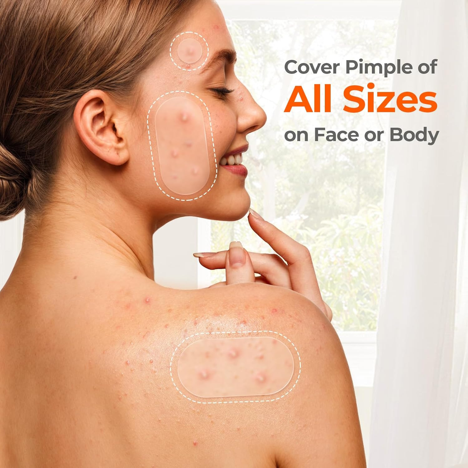 443 Count Pimple Patches for Face, Hydrocolloid Acne Patch Bulk, Acne Stickers f