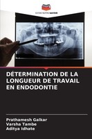 DÉTermination DE LA Longueur DE Travail EN Endodontie Aditya Idhate