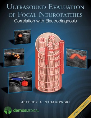 Ultrasound Evaluation of Focal Neuropathies: Correlation with Electrodiagnos...