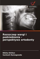 Rozszczep Wargi I Podniebienia - Perspektywa Ortodonty Nikita Khillon