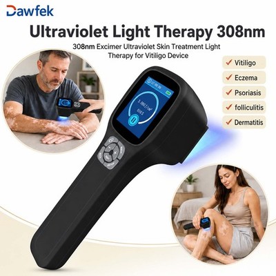 Portable 308nm Excimer Light Device LCD Adjustable Dose Skin Care Home Kit Use