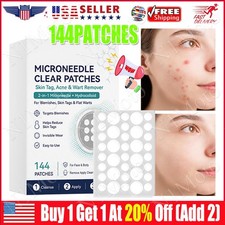 2026 NEW Curalona Microneedle Patches 144pcs, Skin Tag Wart Acne Remover Patches