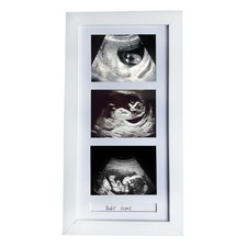 Pine Wood Triple Ultrasound Frame, 3 Sonogram Photos, White