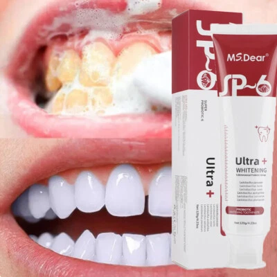 MS.DEAR SP-6 Probiotic Toothpaste,Sp-6 Toothpaste Ultra Whitening Quick White Toothpaste