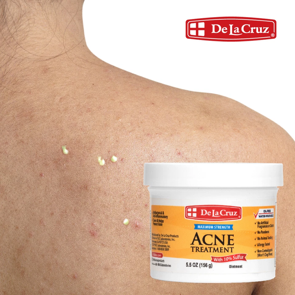 De La Cruz 10% Sulfur Ointment Acne Medication, 3 JUMBO JARS 5.5 OZ Exp 07/27 - Image 4 of 4