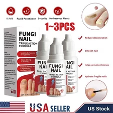 Fungi-Nail Anti-Fungal Liquid Solution Kills Fungus That Can Lead To Nail