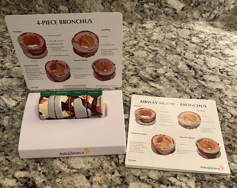 AstraZeneca 4-Piece Bronchus Airway Model Medical Teaching Display w/ Cards