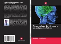 Tuberculose Do CéRebro E Da Coluna Vertebral Vinod K. S. Gautam