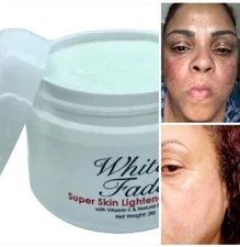 WHITE FADE CREAM: SUPER SKIN LIGHTENER TO REMOVE DARK SPOTS, SIZE 2oz.