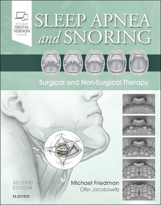 Sleep Apnea and Snoring: Surgical and Non-Surgical Therapy by Michael Friedman (