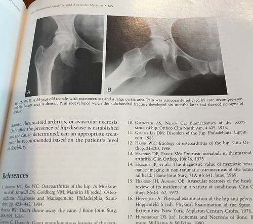 The Hip 1992 Book Medical - Picture 3 of 4