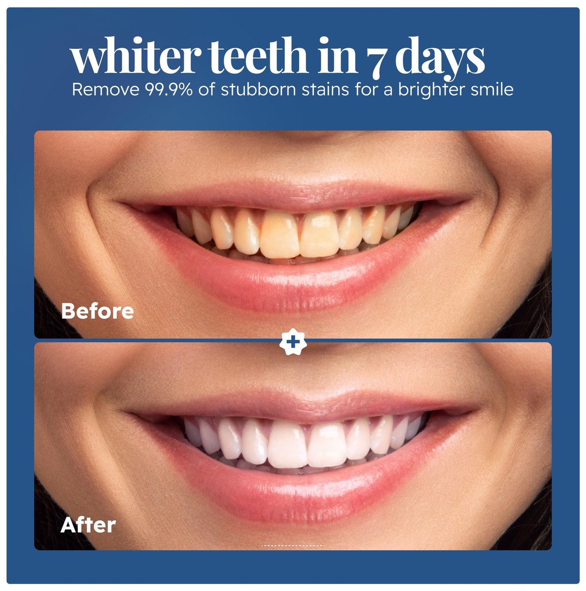 Lumino Teeth® Teeth Whitening Deluxe Powder, Natural Teeth Whitener, Luminoteeth