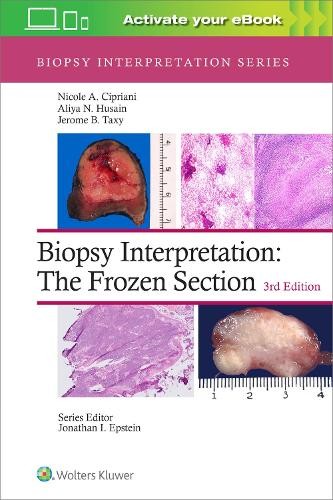 Biopsy Interpretation: The Frozen Section: Print + ---- with... - 9781975170073