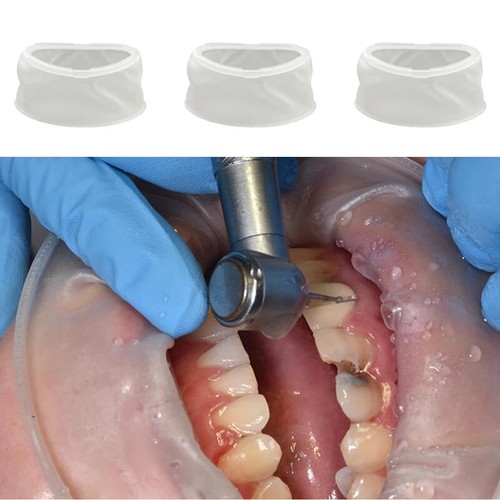Abridor bucal de goma dental 5/10/20 piezas retractores de mejillas ortodoncia oral labio mejilla - Imagen 5 de 6