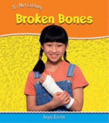 Broken Bones Paperback Angela Royston