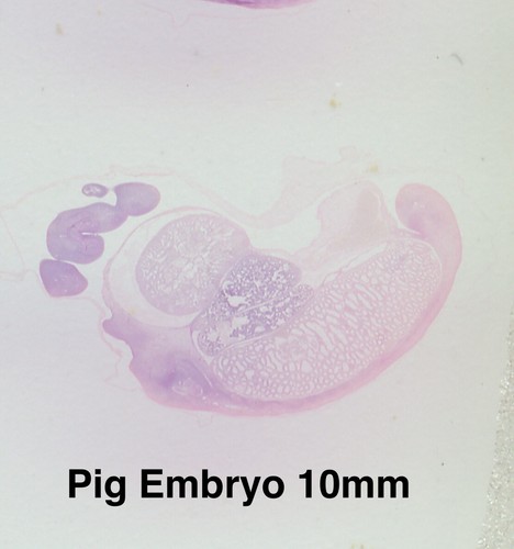 TURTOX Microscope Slide Set HUMAN Histology PATHOLOGY Embryology ORGAN SYSTEMS - Picture 7 of 9