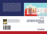 Comparison Between ALL ON 4 AND ALL ON 6 Dental Implants Monika Varma