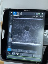 GE Venue 50 Ultrasound Machine with Two Probes Phased and Linear -- Works Great!