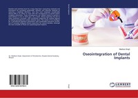 Oseointegration Of Dental Implants Madhavi Singh