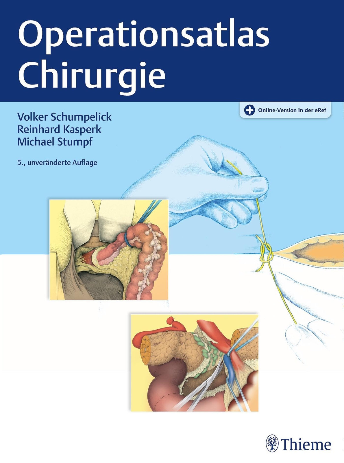 Thumbnail - Volker Schumpelick / Operationsatlas Chirurgie / 9783132438477