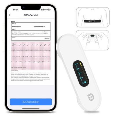 EKG-Gerät Brustgurt 30s-15min EKG Aufzeichnung AI-Analyse per App erkennt AFib