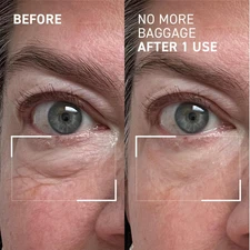 Dr. Brandt Needles No More, No More Baggage - Minimizes Under-Eye Bags, Puffi...