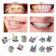 Dental Orthodontic Roth/MBT/Edgewise 018/022 3/345/No Hook Metal Bracket Brace