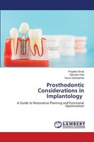 Prosthodontic Considerations In Implantology Prajakta Ghule