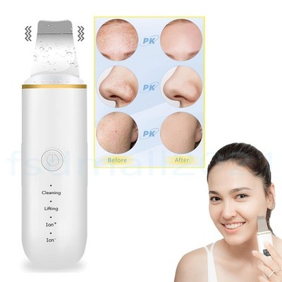 Ultraschall Facial Skin Scrubber Face Pore Deep Cleaner Spatula Blackhead Remove