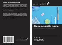 RáPida ExpansióN Maxilar Rachna Jangu