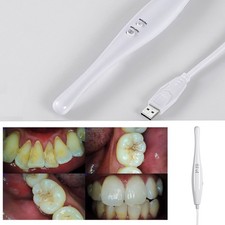 Dental Intraoral Camera USB Digital Imaging Intra Oral HD Camera 13.0 Mega Pixel