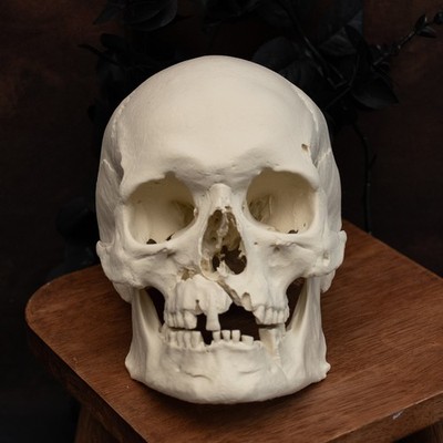 Menschlicher Schädel Replik | Lebensgroß | Mittelalter Krieger Axt Wunde | Anatomisches Modell