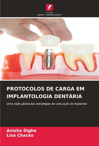 Protocolos DE Carga EM Implantologia DentÁRia Anisha Dighe-image