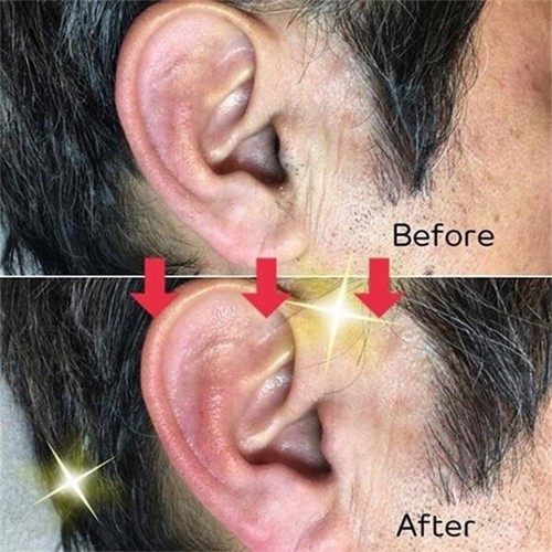 Nose Ear Hair Removal Wax Kit Painless & Easy Mens Nasal Waxing Strip Remover - Picture 8 of 23