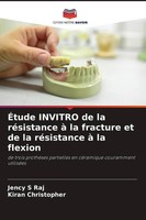 ÉTude Invitro De La RéSistance à La Fracture Et De La RéSistance à La Flexion Je