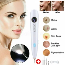 Laser Plasma Pen Tattoo Mole Freckle Spot Mole Removal Skin Tag Wart Remover Pen