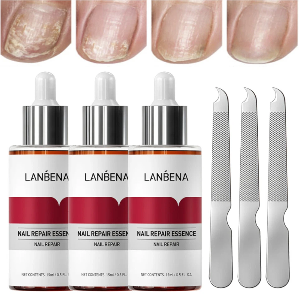 3 x LANBENA Nail Repair Essence Remove Onychomycosis Serum Fungal Nail Treatment
