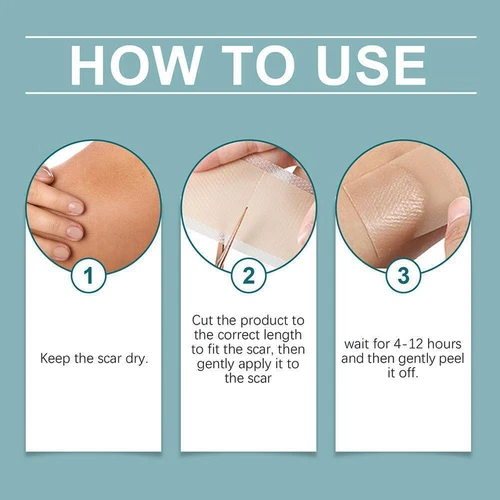 Silicone Scar Sheets,Silicone Scar Tape,Silicone Sheets BEST For Scars X2J4 - Picture 9 of 13