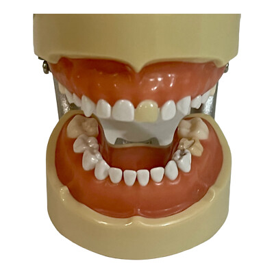 Kilgore Nissin Typodont Dental Study Model w/Removable Teeth