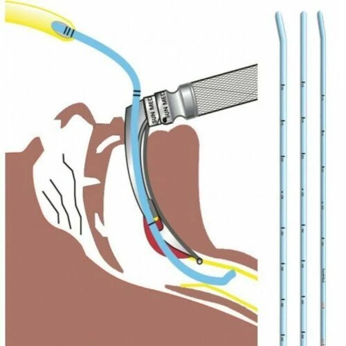 Medical Endoscopes Gastroscope