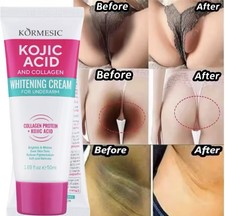 Collagen Kojic Acid Whitening Cream