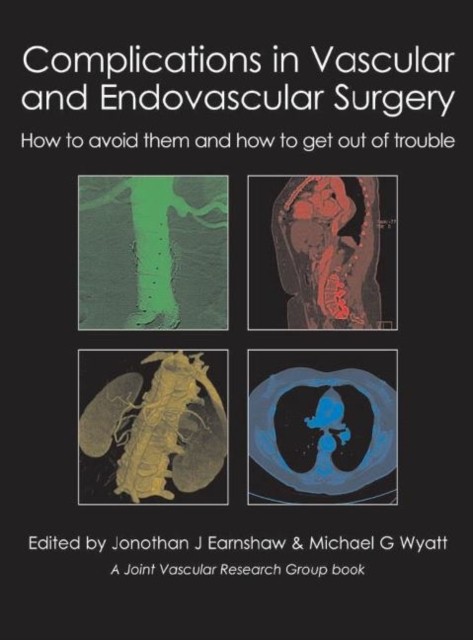 Complications in Vascular and Endovascular Surgery (Hardback Book)